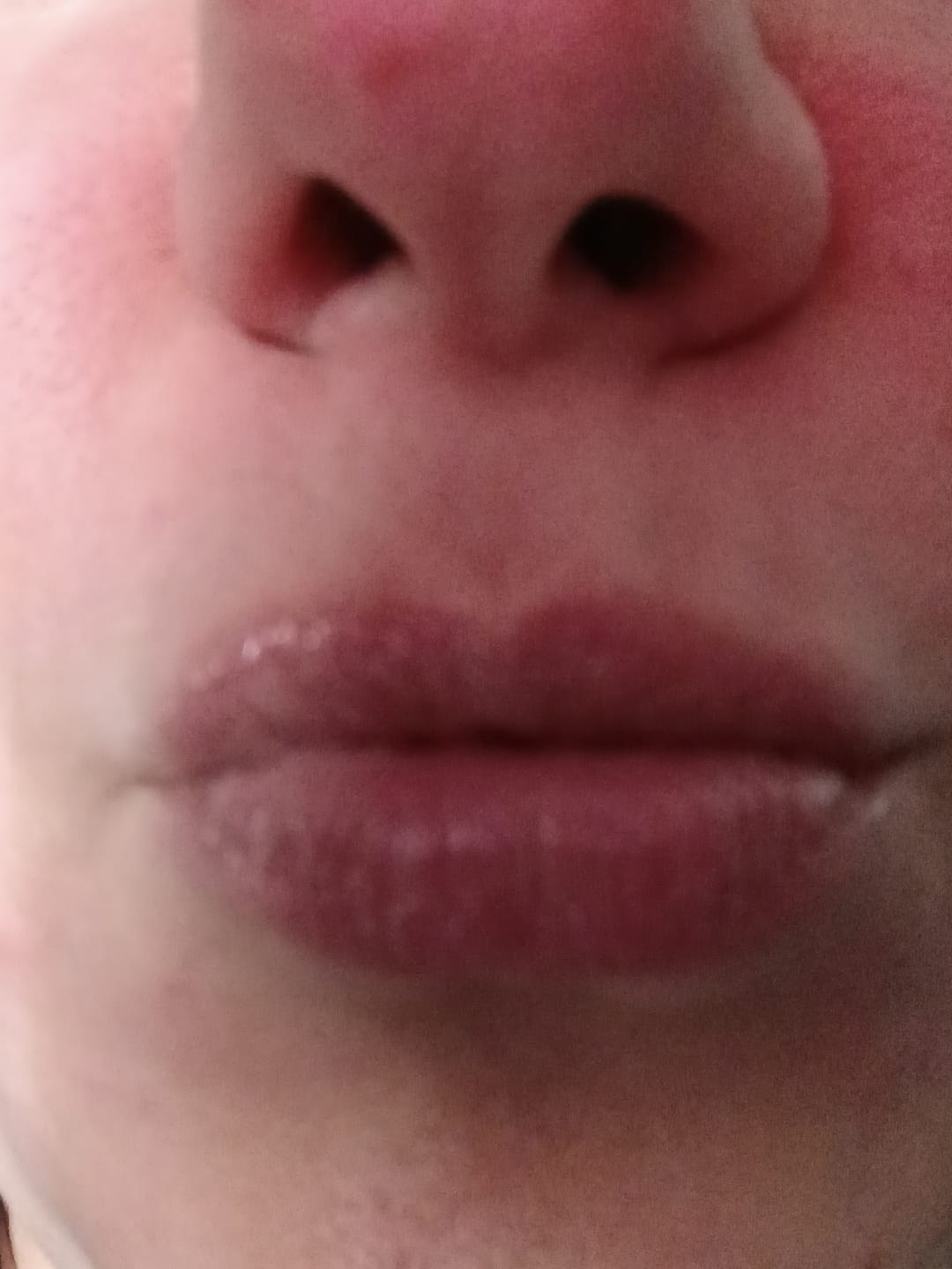 Vásárlói fotóértékelés a Protect Your Pout kulcstartó ajakápolóról