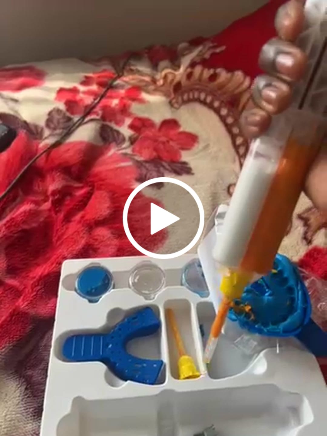 Customer video review of Upper Impression Kit