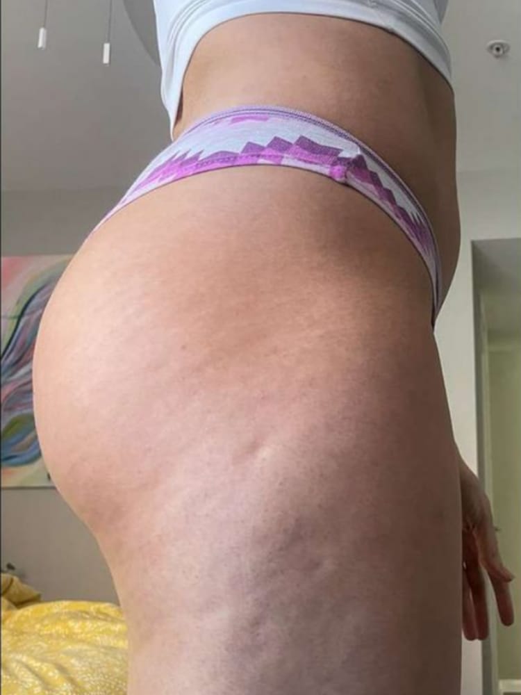 Customer photo review of Dispositivo de Moldeo Corporal Nova Sculpt