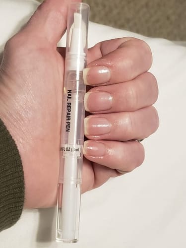 Customer photo review of MyCurePro® · Elimina Fungos nos Pés e Mãos · 7 Dias