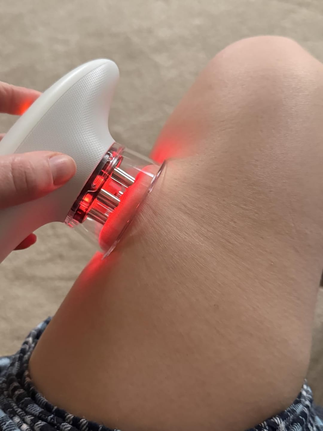 Customer photo review of Dispositivo de Moldeo Corporal Nova Sculpt