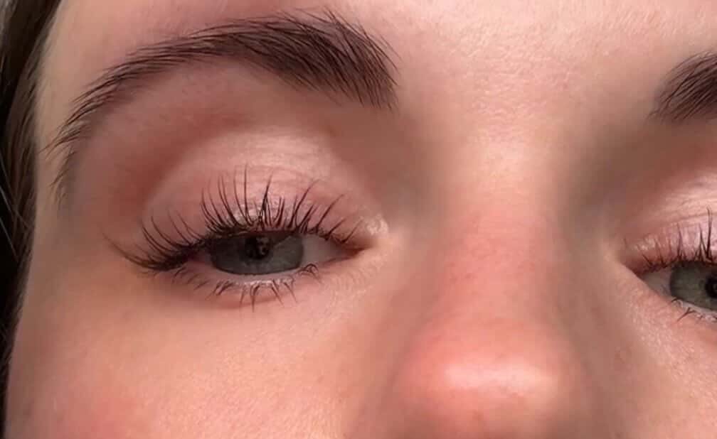 Customer photo review of Wimpernserum