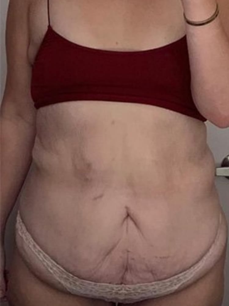 Customer photo review of Dispositivo de Moldeo Corporal Nova Sculpt