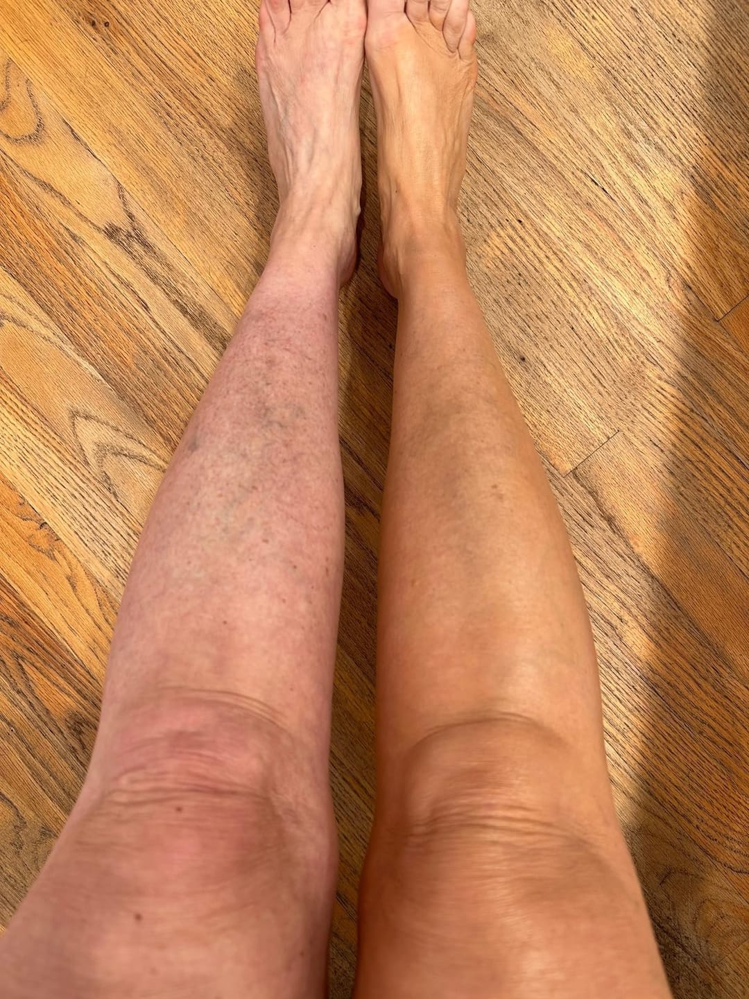 Customer photo review of Perfektor do Ciała