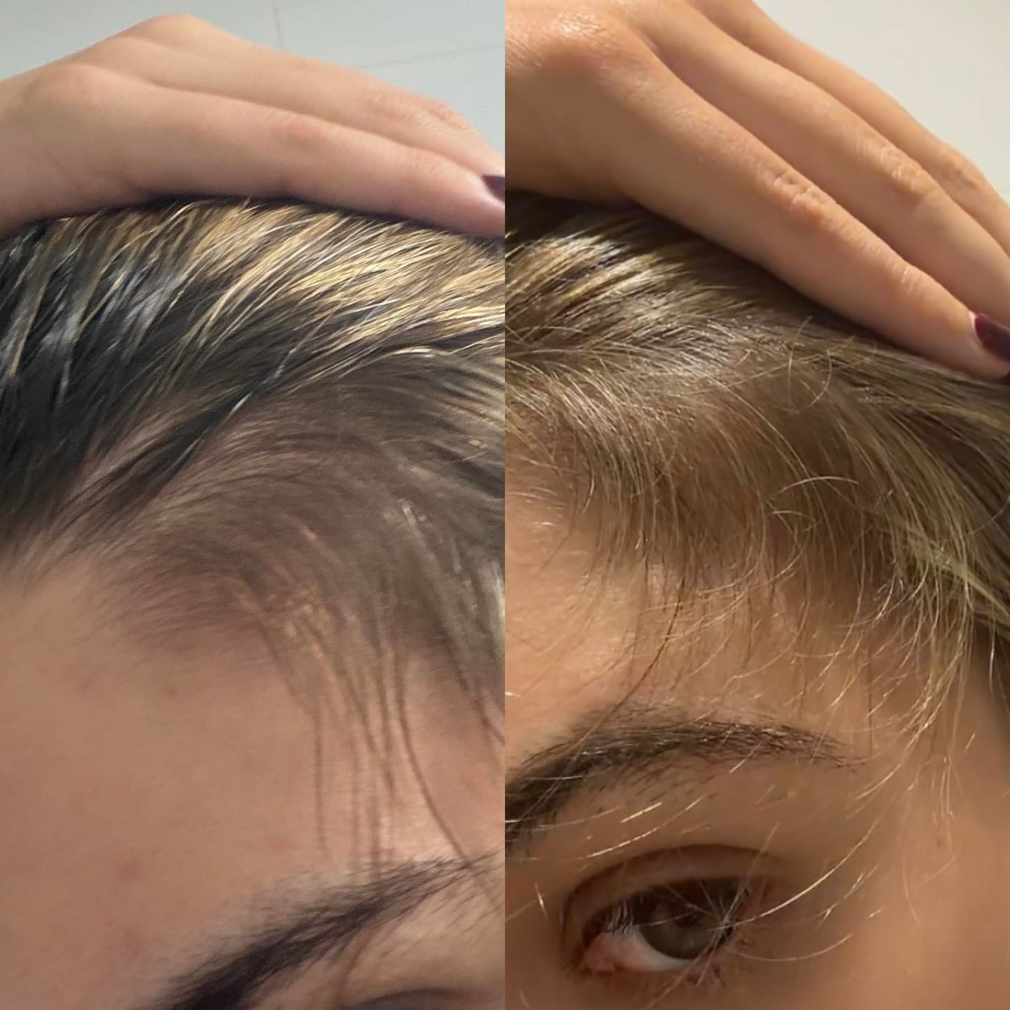 Customer photo review of Gloss Hair Growth Shampoo with GHK-Cu Copper Peptides