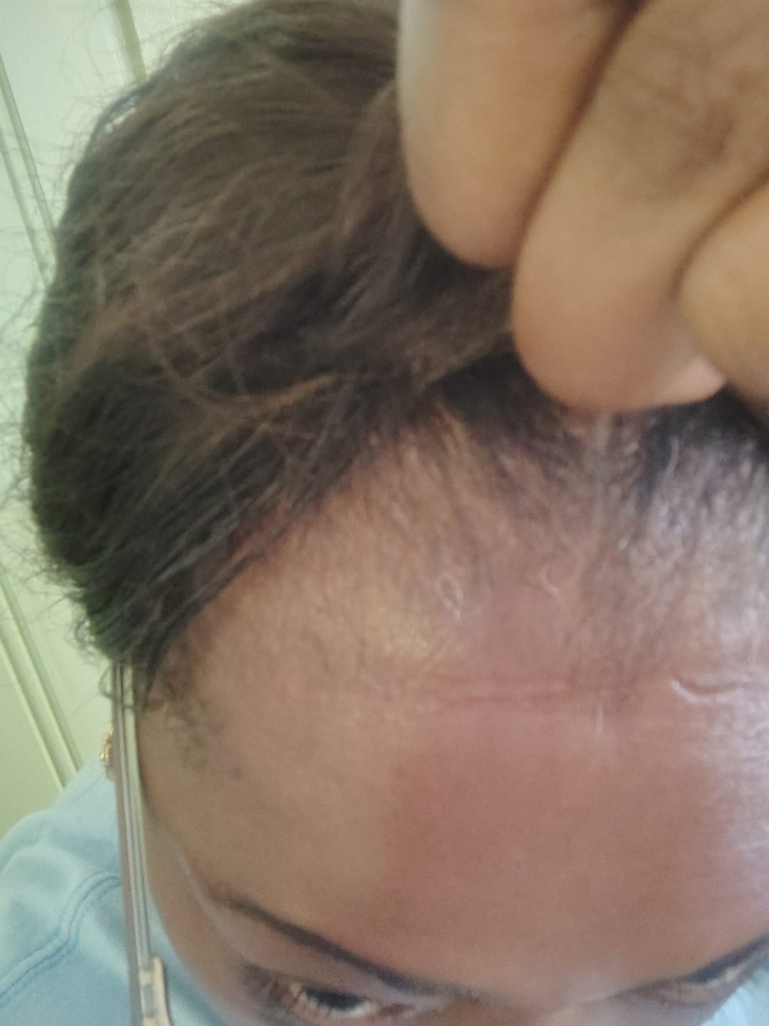 Customer photo review of BALM- Stimulating Scalp and Hair Balm