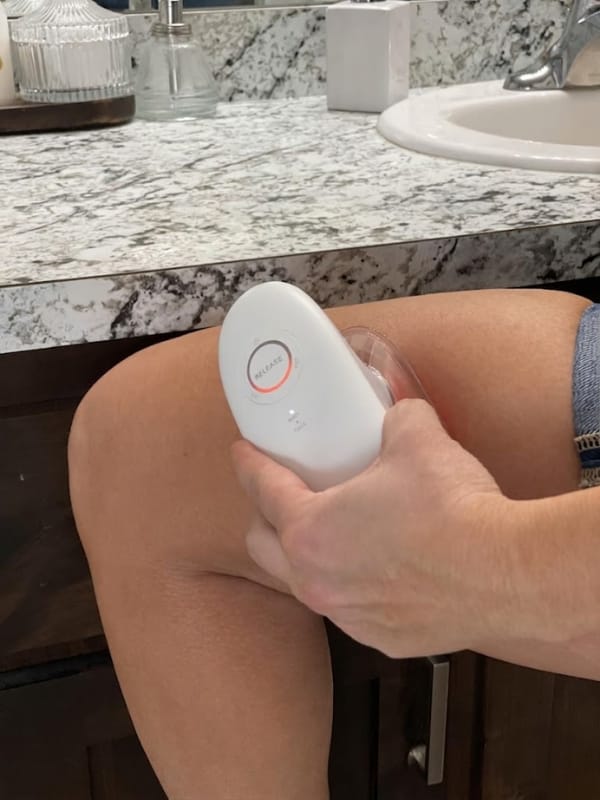 Customer photo review of Dispositivo de Moldeo Corporal Nova Sculpt