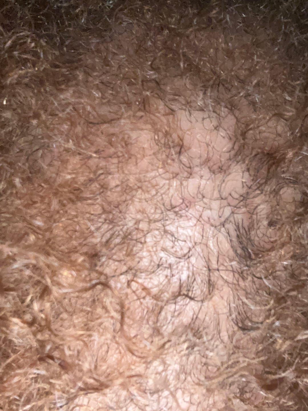 Customer photo review of Rennora EXTRA-Strength Hair Growth Serum