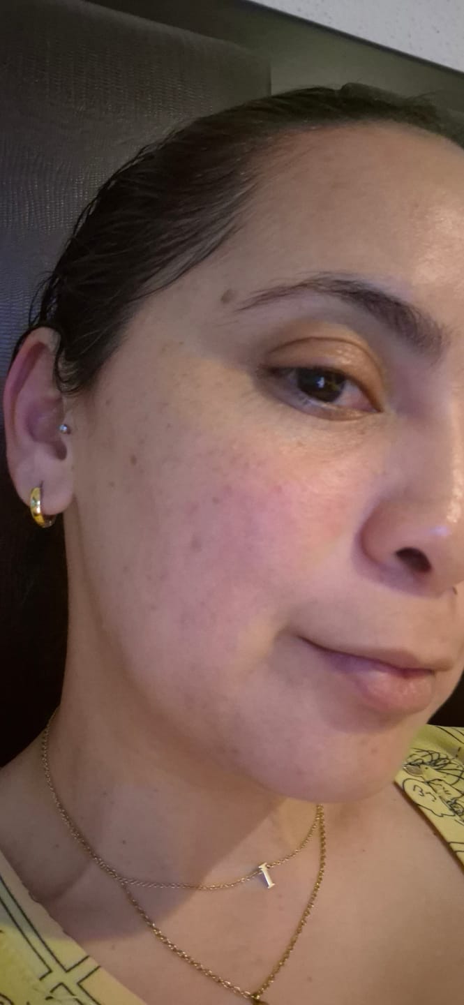 Customer photo review of The Super Glo Hydro Boost Jelly Moisturiser