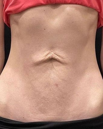 Customer photo review of Dispositivo de Moldeo Corporal Nova Sculpt