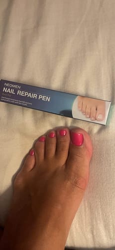 Customer photo review of MyCurePro® · Elimina Fungos nos Pés e Mãos · 7 Dias