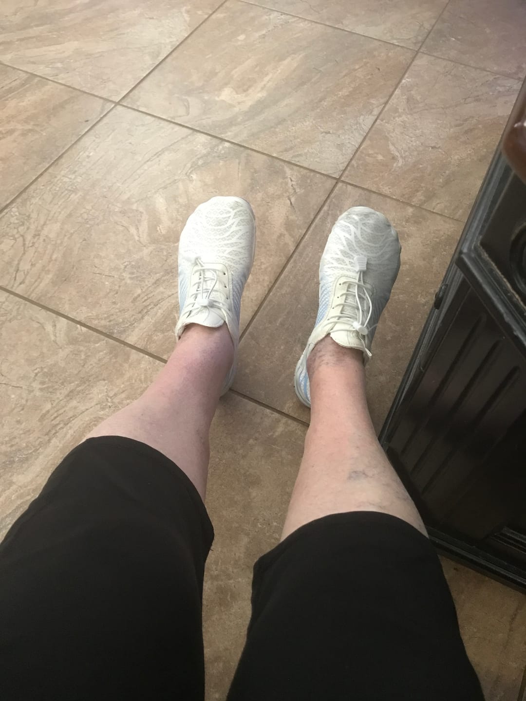 Customer photo review of UniGrip - Optimal Health & Traction Shoes (Unisex)