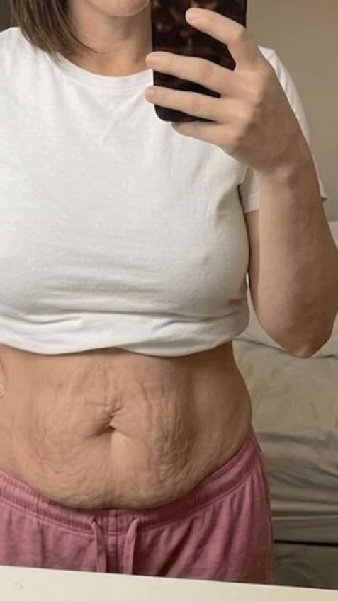 Customer photo review of Dispositivo de Moldeo Corporal Nova Sculpt