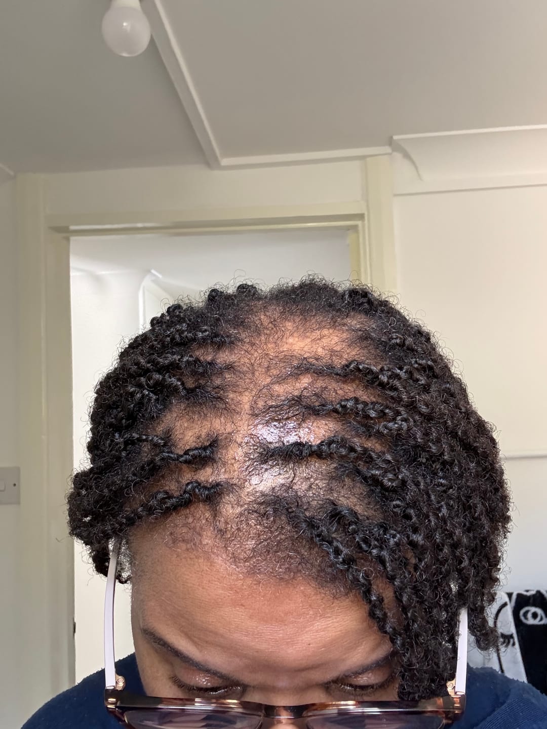 Customer photo review of XL HYDRATING MIST