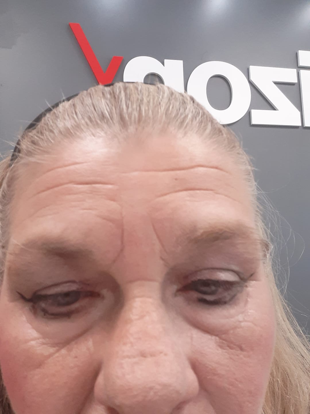 Customer photo review of Glov Micro Infusion System