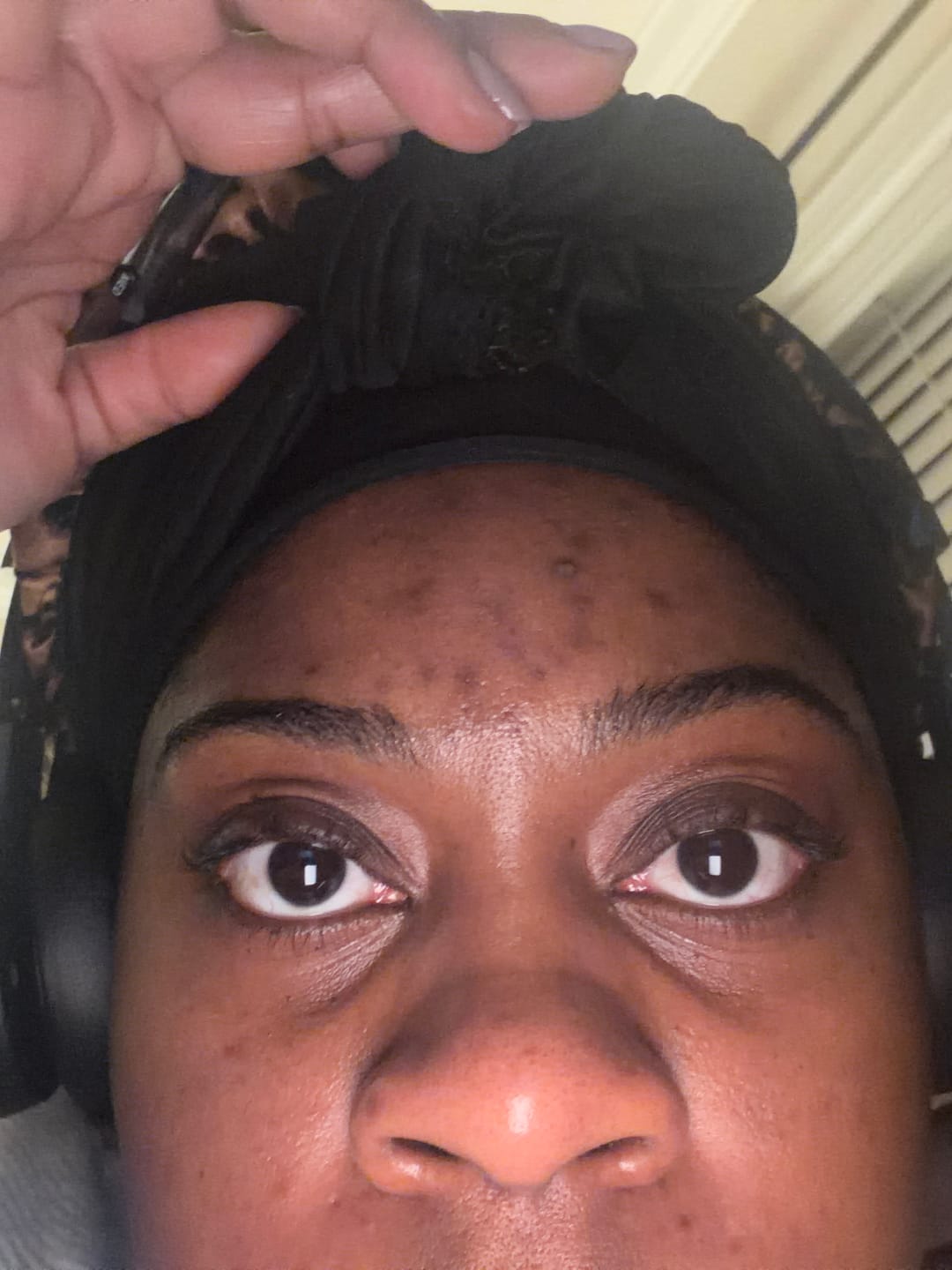 Customer photo review of Turmeric Fade & Glow Bar