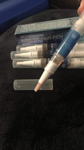 Customer photo review of MyCurePro® · Elimina Fungos nos Pés e Mãos · 7 Dias