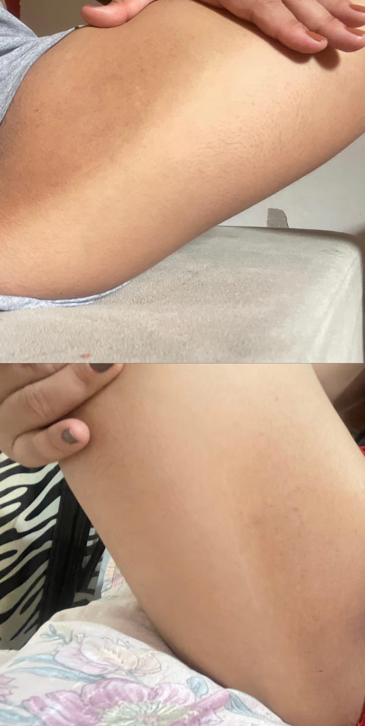 Customer photo review of Sérum Clareador Íntimo 30ml