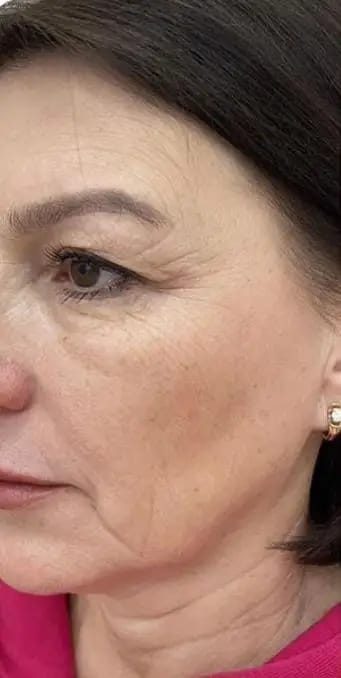 Customer photo review of DermaSculpt Pro - By Oracitive™