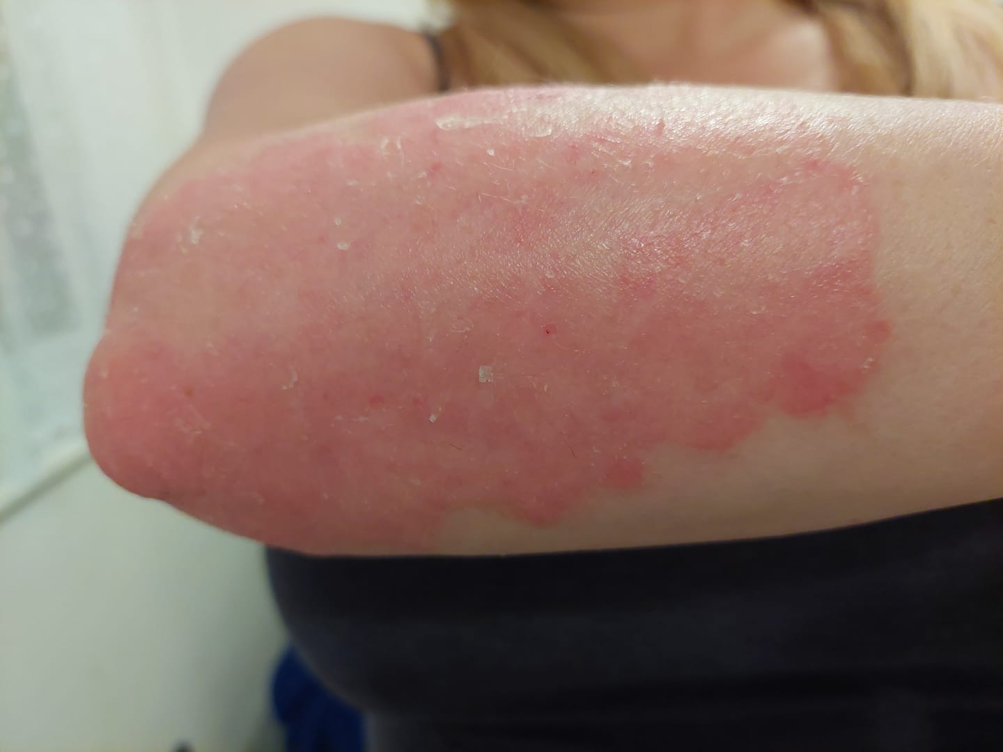 Customer photo review of Multi Strain Biotic