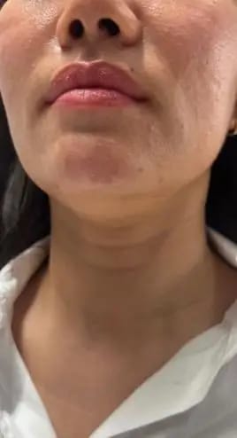 Customer photo review of DermaSculpt Pro - By Oracitive™