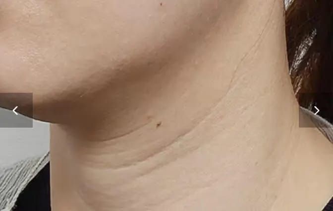 Customer photo review of DermaSculpt Pro - By Oracitive™