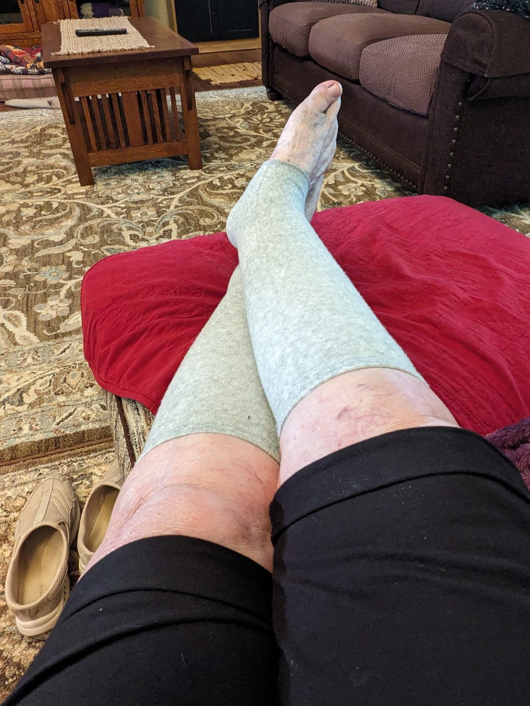 Customer photo review of Premium Anti-Fatigue Bamboo Footsleeves