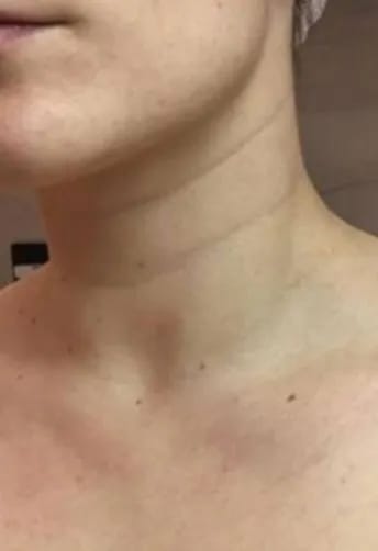 Customer photo review of DermaSculpt Pro - By Oracitive™