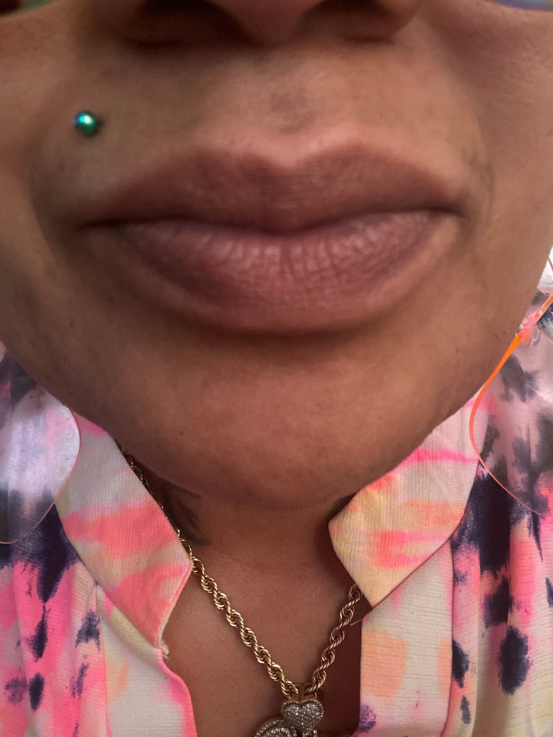 Customer photo review of Brightening Lip Bundle