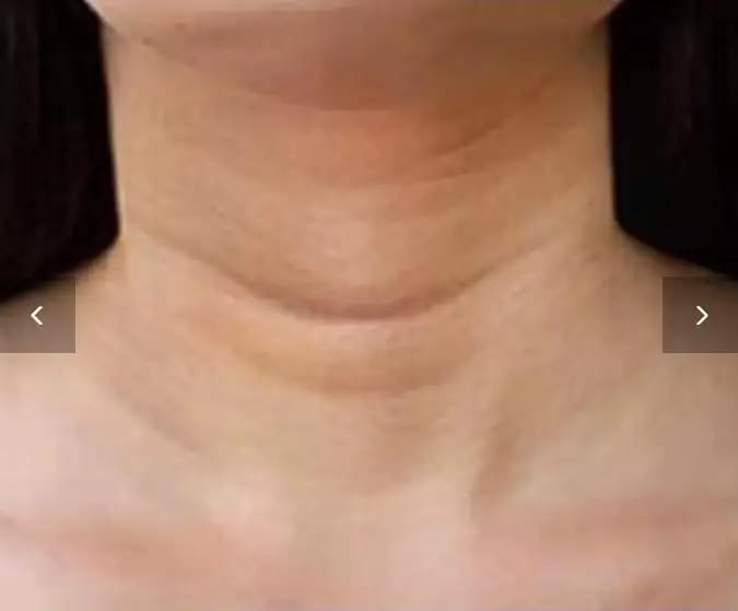 Customer photo review of DermaSculpt Pro - By Oracitive™