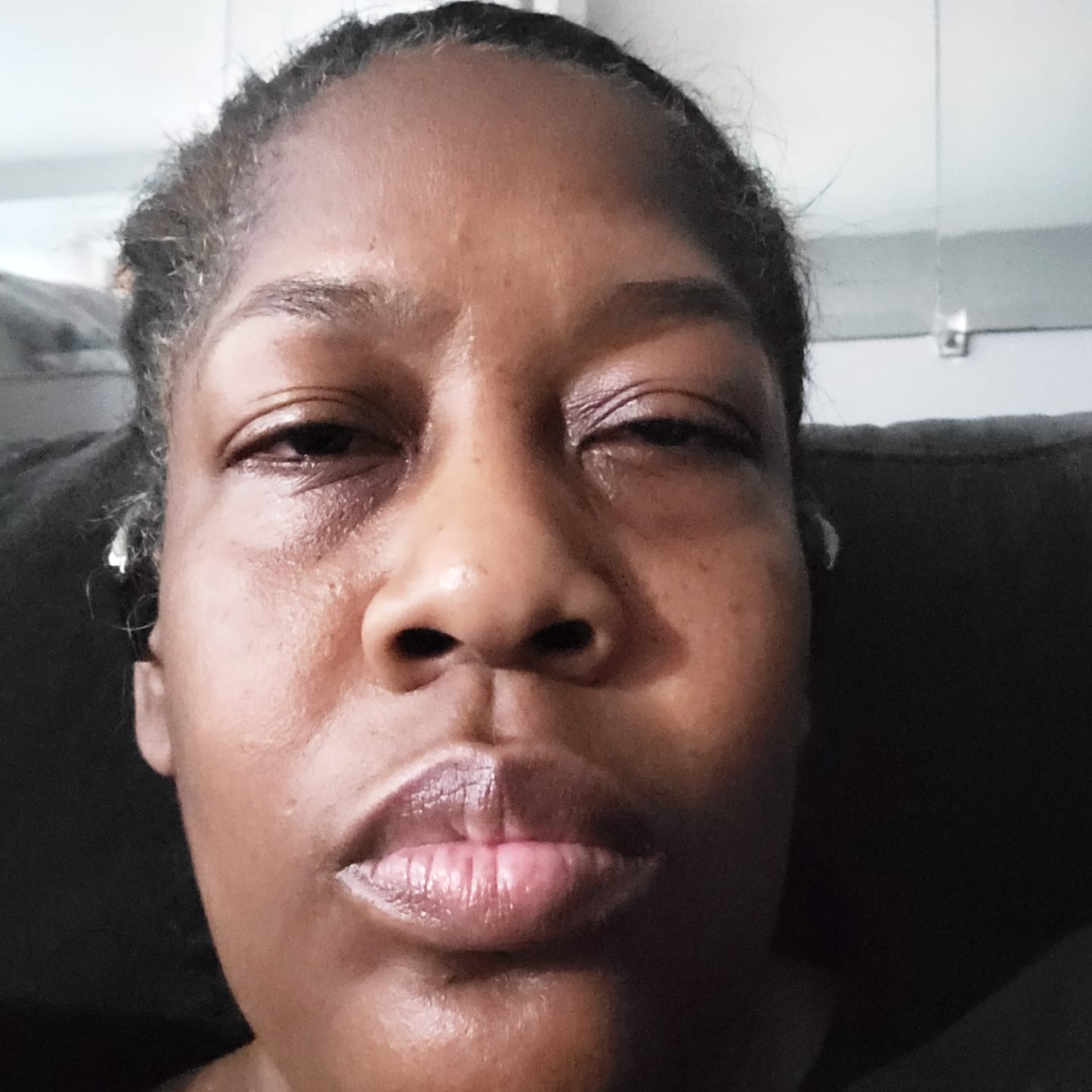 Customer photo review of Turmeric and Kojic Foaming Face Wash