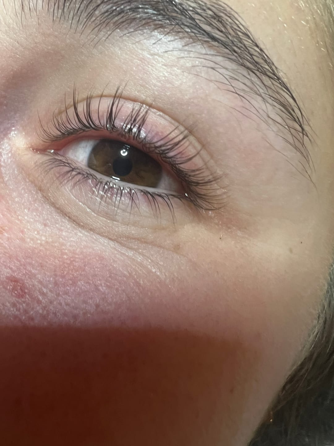 Customer photo review of TGA vs Cysteamine