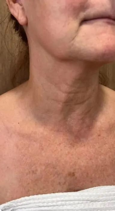 Customer photo review of DermaSculpt Pro - By Oracitive™