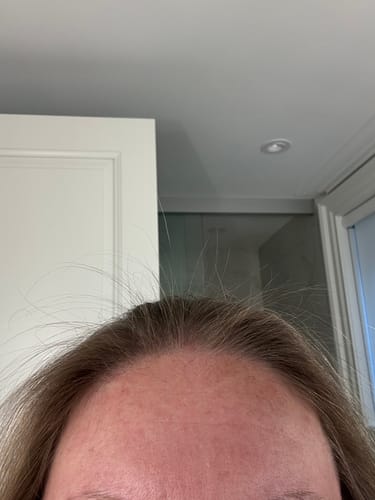 Customer photo review of Pre-Wash Scalp Oil by TR