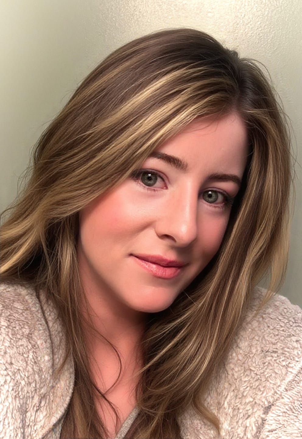 Customer photo review of The Micro Infusion System™ 3 Month | 6 Treatments