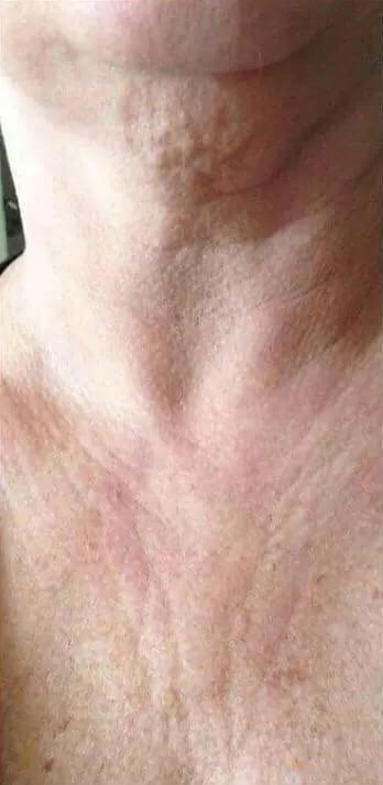 Customer photo review of DermaSculpt Pro - By Oracitive™