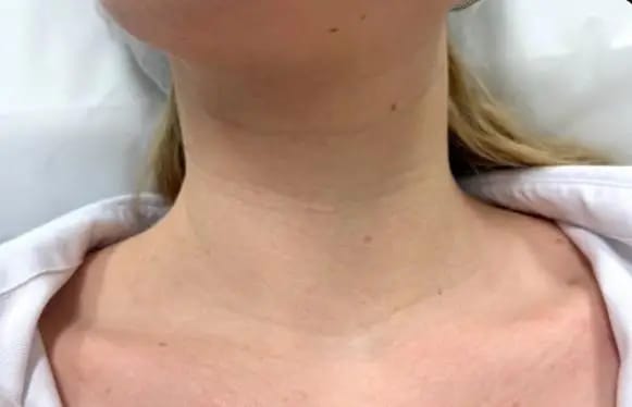 Customer photo review of DermaSculpt Pro - By Oracitive™