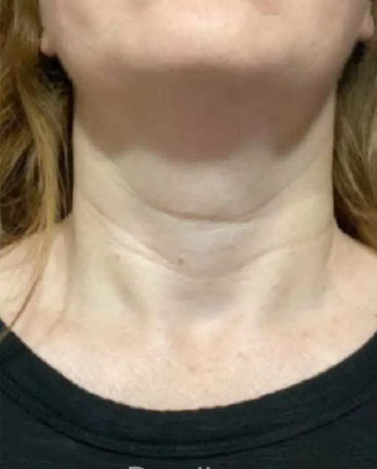 Customer photo review of DermaSculpt Pro - By Oracitive™