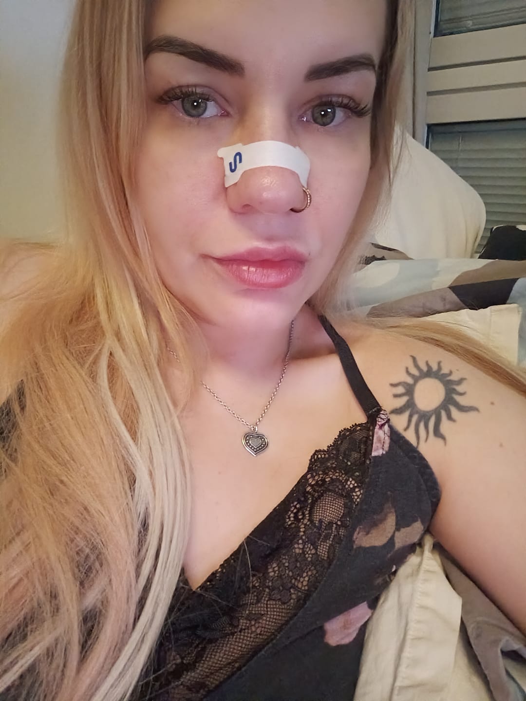 Customer photo review of Nuku Sleep Nasal Strips