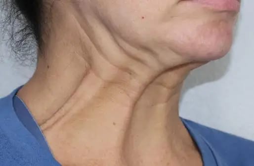 Customer photo review of DermaSculpt Pro - By Oracitive™