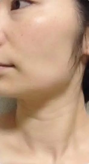 Customer photo review of DermaSculpt Pro - By Oracitive™