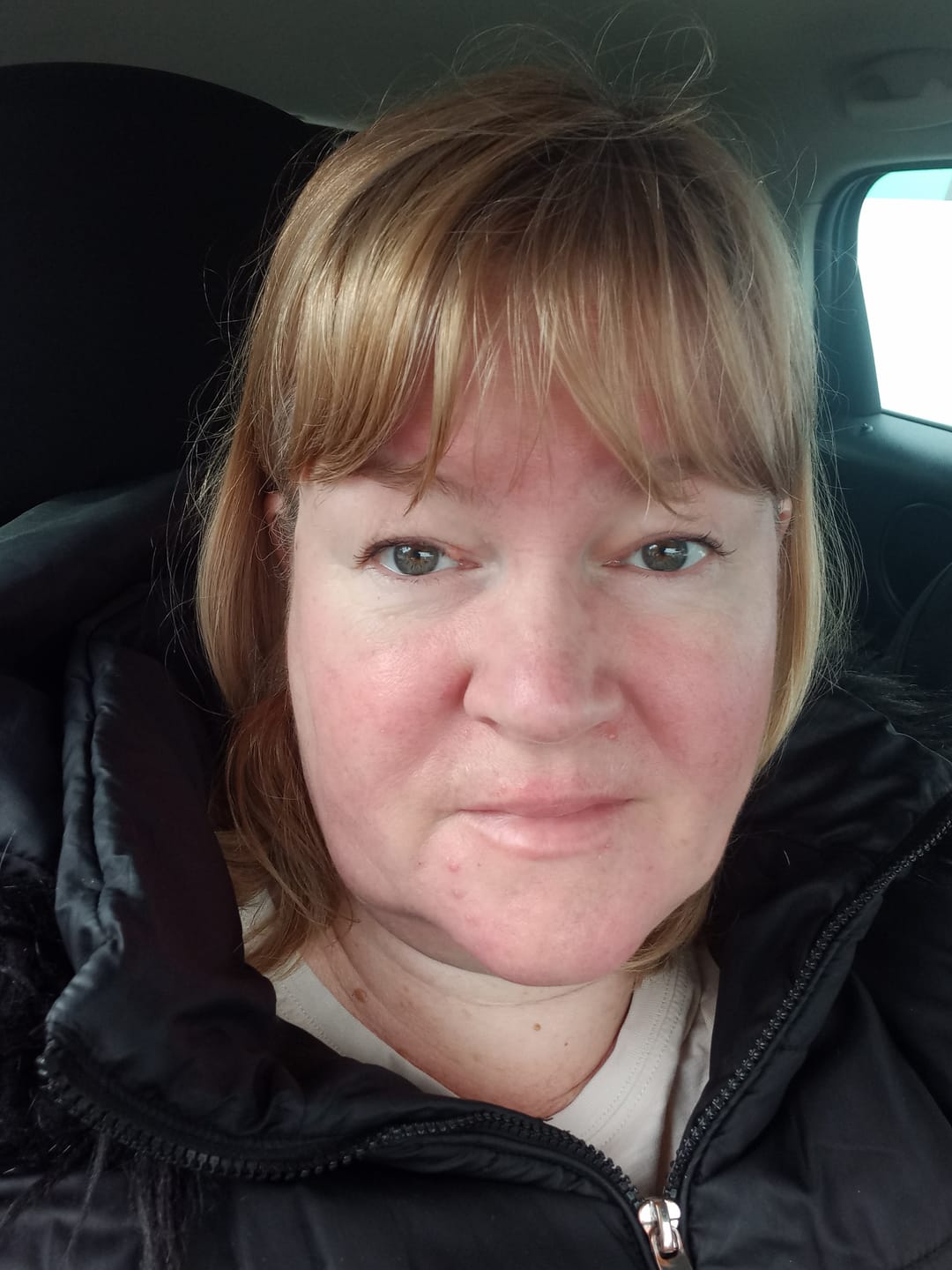Customer photo review of Rosalique Redness Relief Day Cream