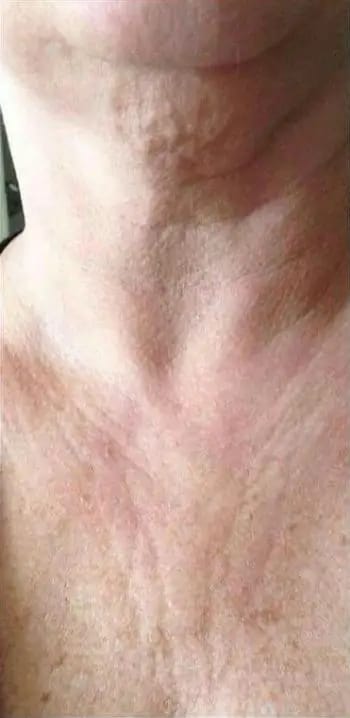 Customer photo review of DermaSculpt Pro - By Oracitive™