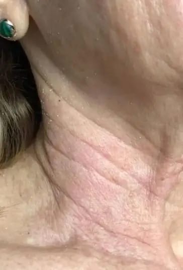 Customer photo review of DermaSculpt Pro - By Oracitive™