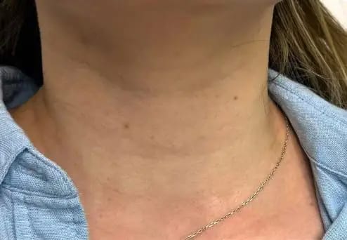 Customer photo review of DermaSculpt Pro - By Oracitive™