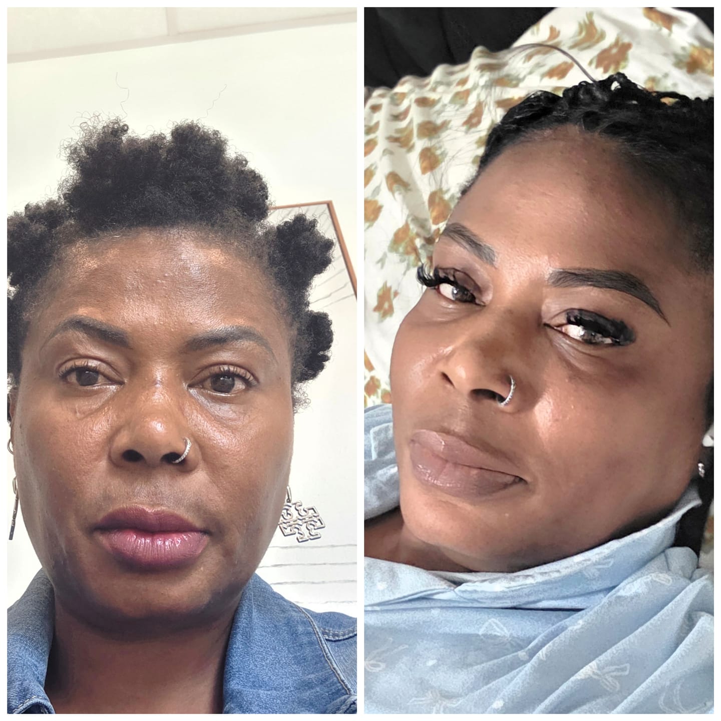 Customer photo review of GLO MELANIN