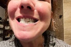 Customer photo review of GlorySmile™ V34 Whitening Toothpaste (30 ml)