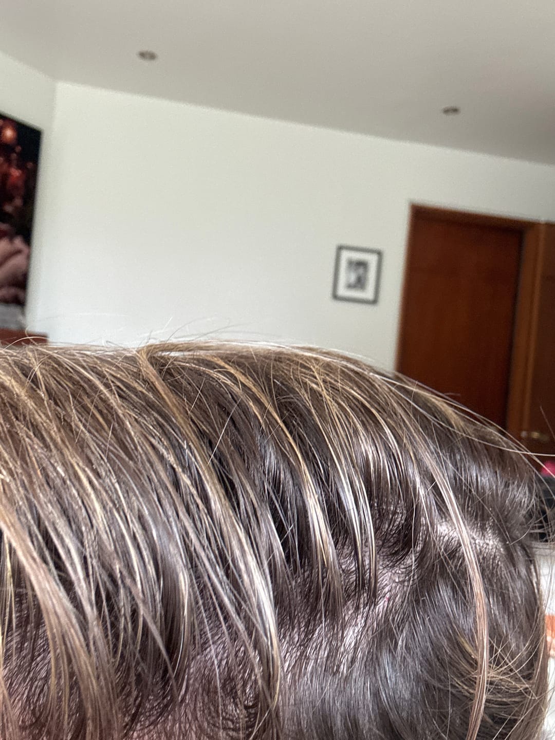 Customer photo review of Shampoo Control Crecimiento + Desinflamación 70g