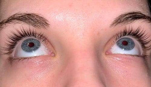 Customer photo review of BOOSTER Serum