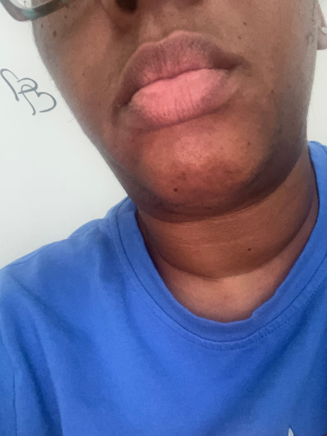 Customer photo review of Melanin Skin Bundle